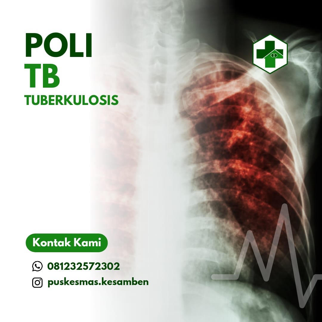 POLI TB UPT Puskesmas Kesamben